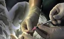 爱优选icrm做三代试管的费用明细是怎样的？