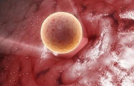 试管反复促排失败的原因？